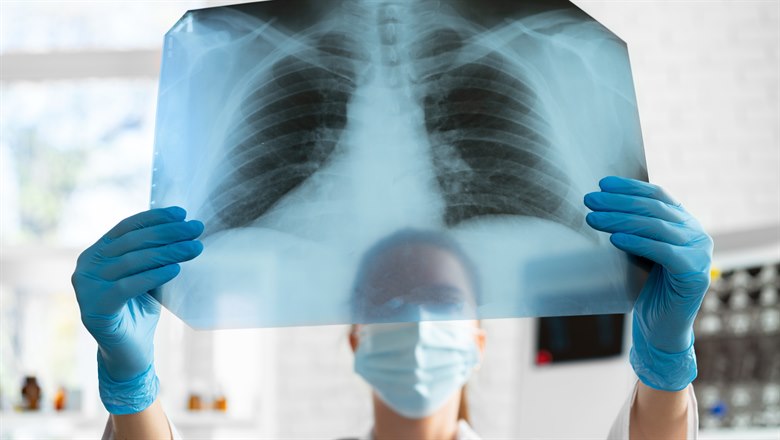 Kvinnlig läkare som tillta på en röntgenbild över en bröstkorg och lungor.